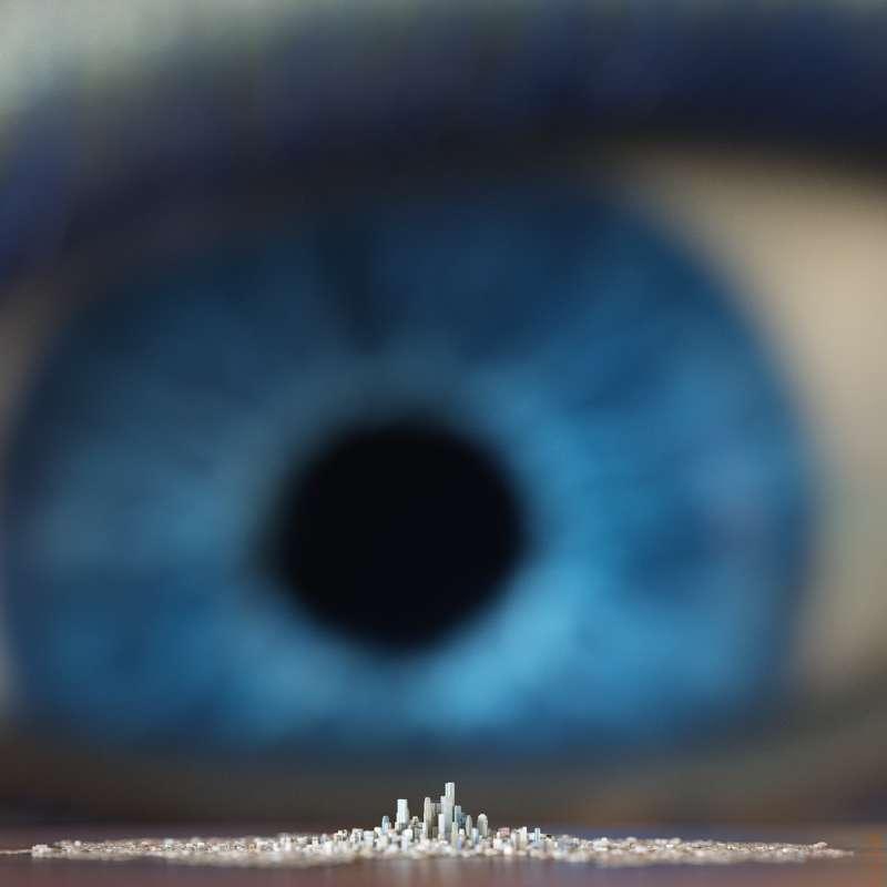 Eye