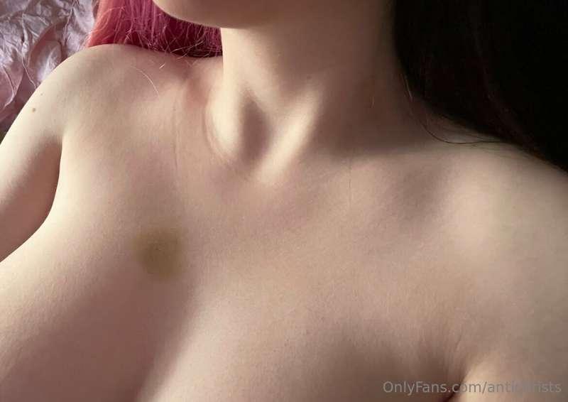 hickeys…..