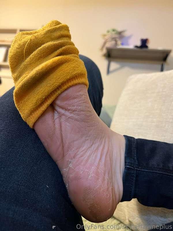 When you decided to do a foot peel mask and now your foot lo..