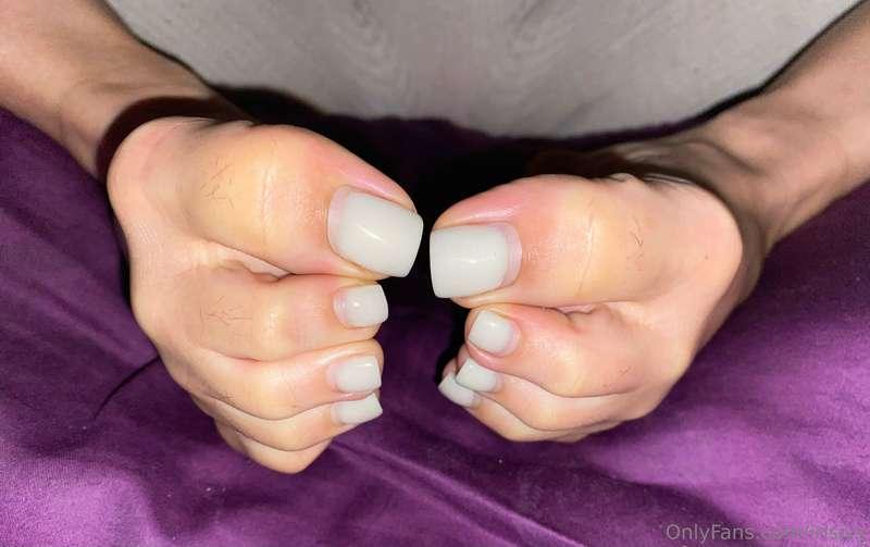 These are my toes today. What color should I get next ?